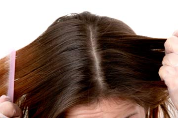 How it affect the scalp 