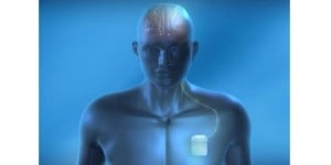 brain activity stimulator