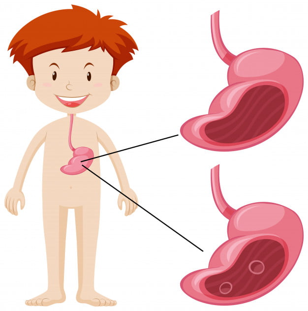 stages of stomach cancer