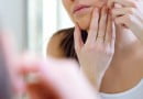 skin tightening home remedies