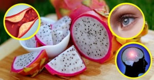 Control High Cholesterol
