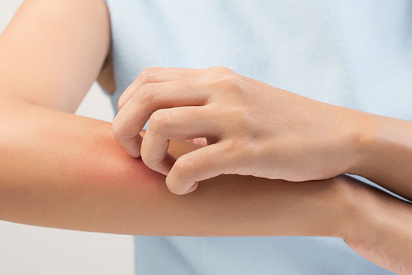 Reduce Skin Infections