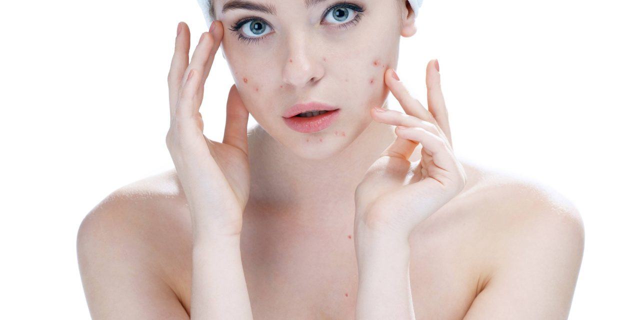 Reduce Pimples