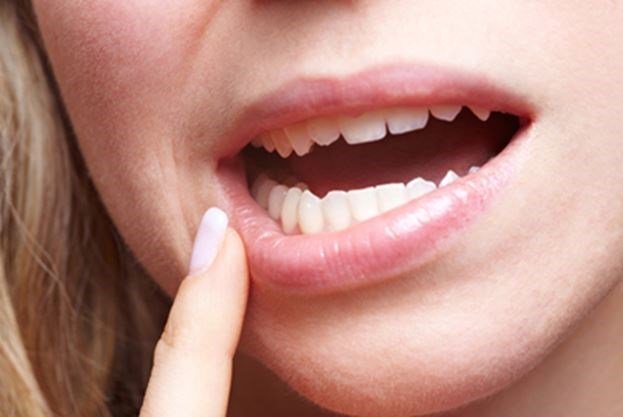 Tooth Decay or Gum Disease