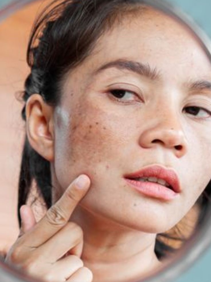 Removes Dark Spots