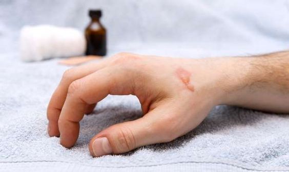 Inflammation In The Body