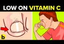 Vitamin C Deficiency1