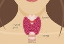 Thyroid Disease