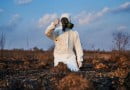 Things You Should Know About the Treatment of Chemical Burns